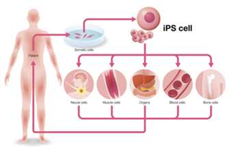 XellSmart Leads Global Breakthroughs in iPSC-Based Cell Therapie